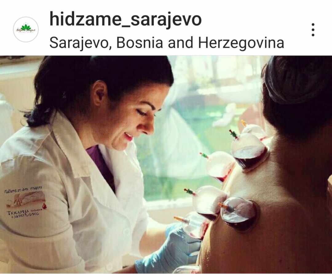 Hidzama Sena Sarajevo - foto 2