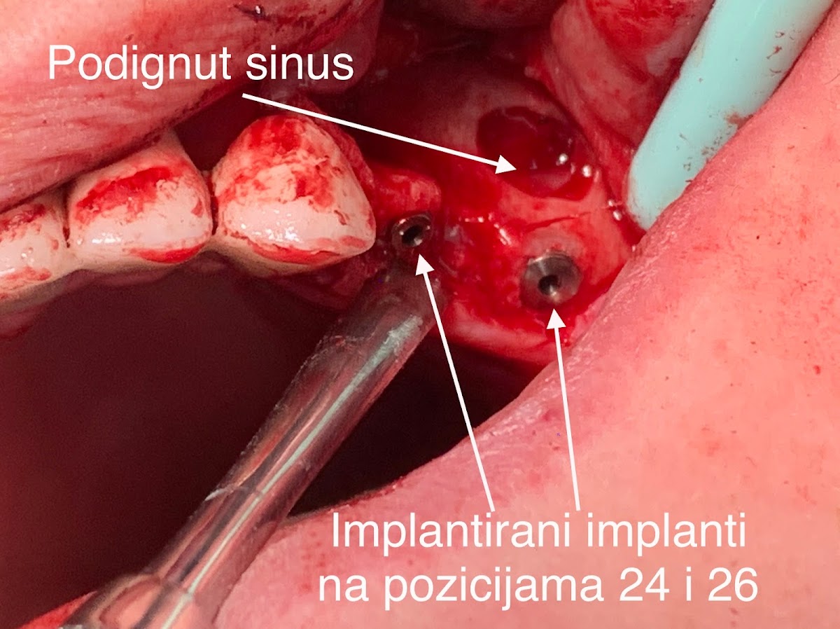 Stomatoloska ordinacija H&E - foto 2