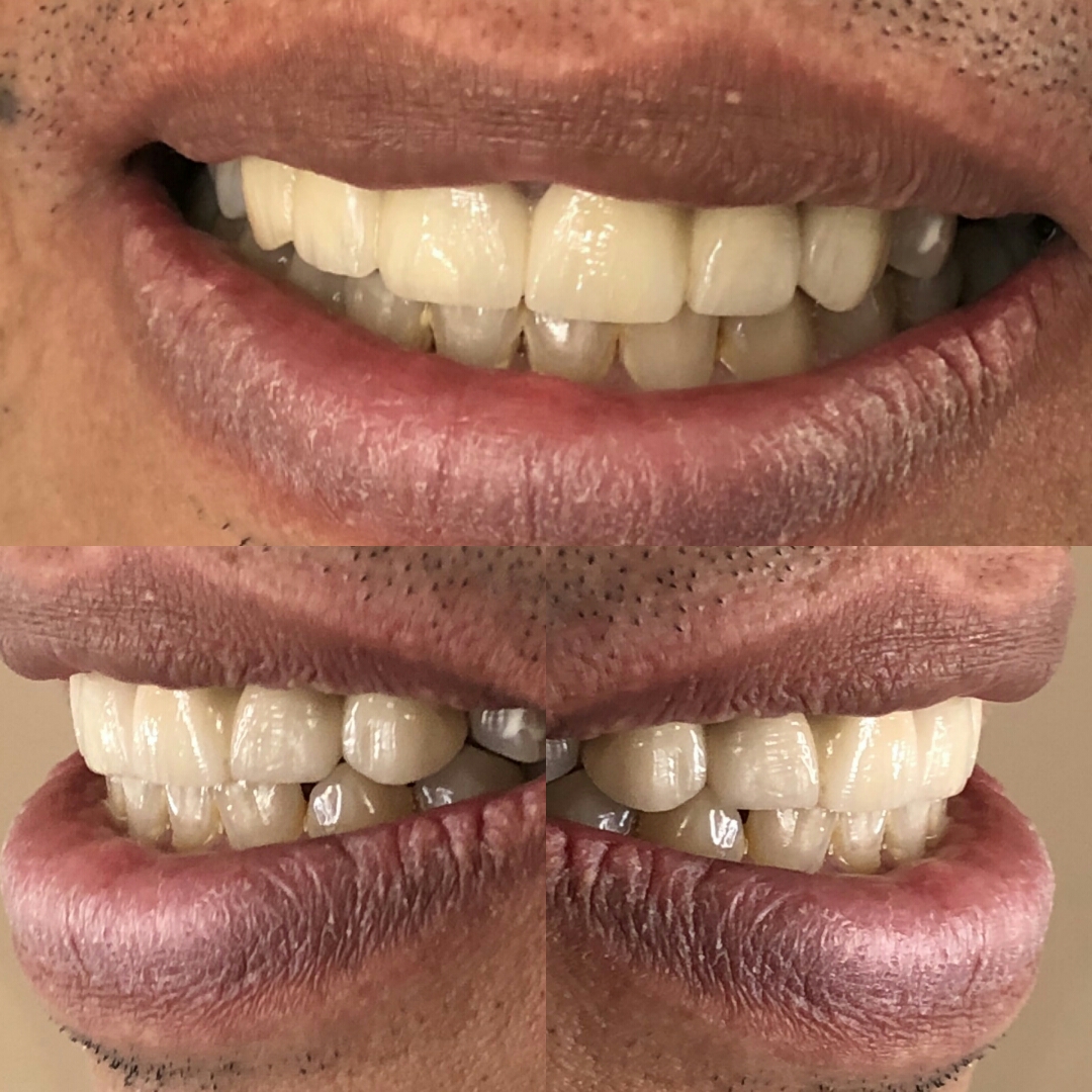 Stomatoloska ordinacija Mujic dr. Alen