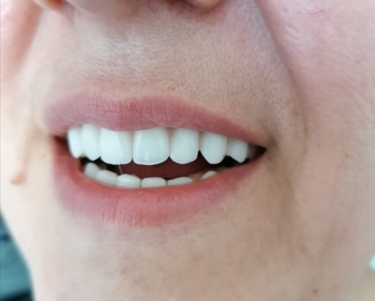 Privatna stomatoloska ordinacija Nova Otoka