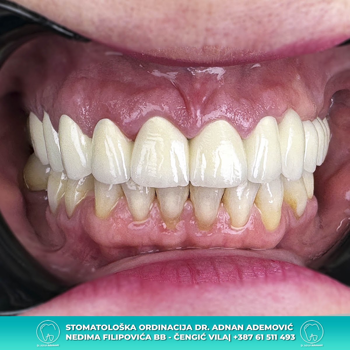 Stomatološka Ordinacija Ademović Sarajevo - foto 2