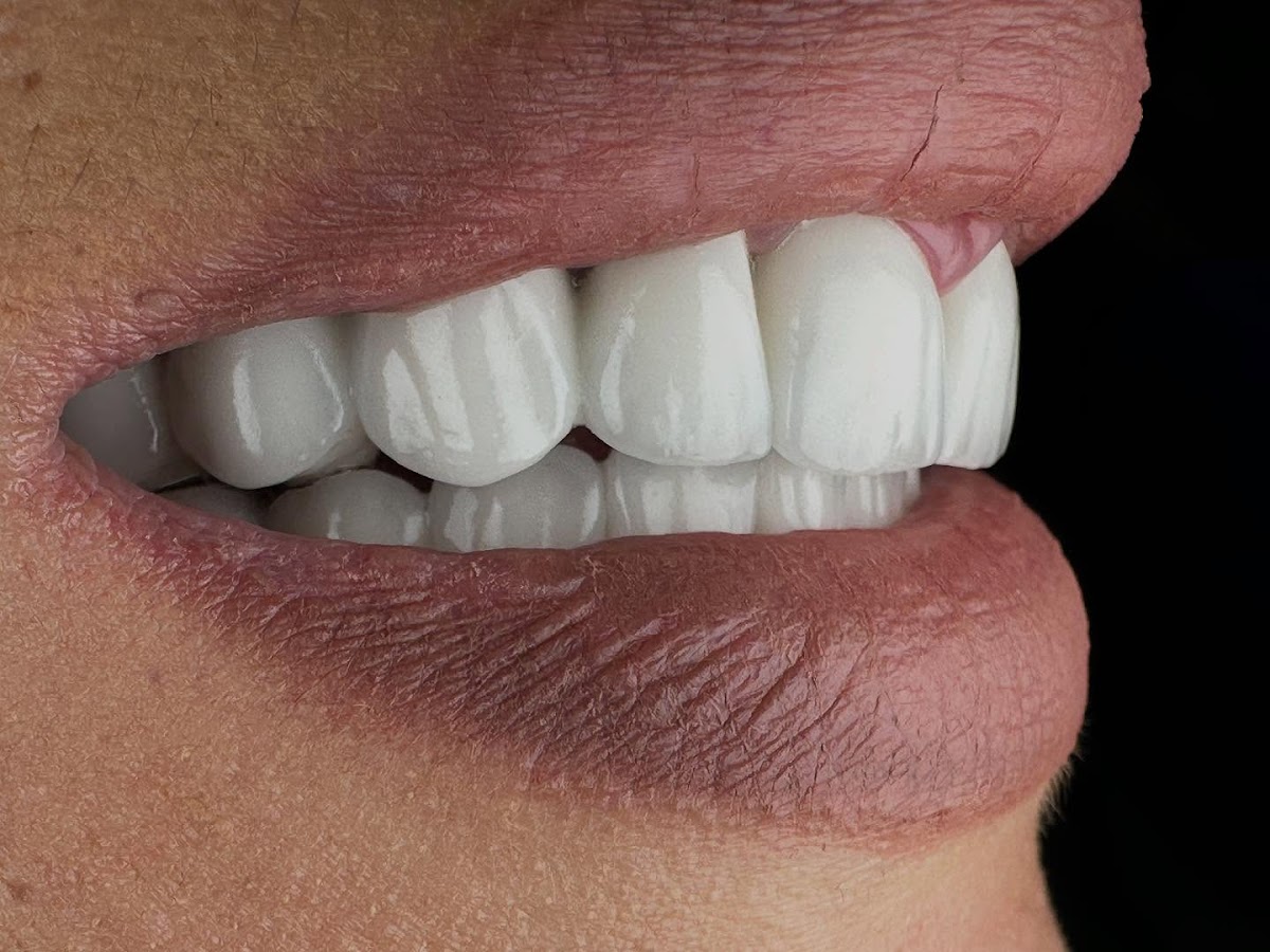 Stomatološka Ordinacija Ademović Sarajevo - foto 3