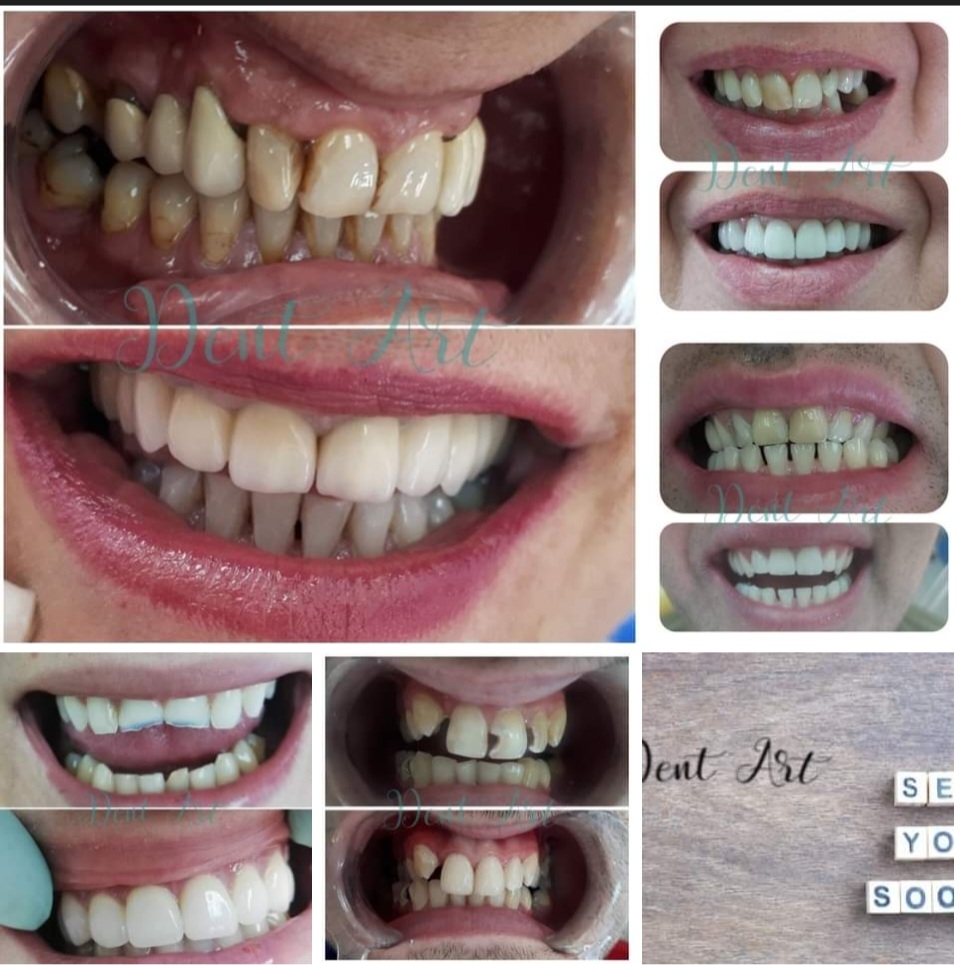 DentArt - foto 2