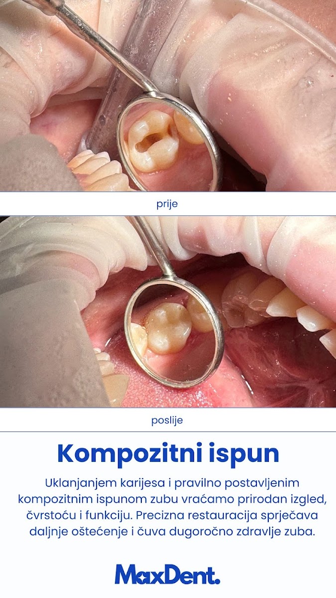 Stomatološka ordinacija MaxDent Sarajevo