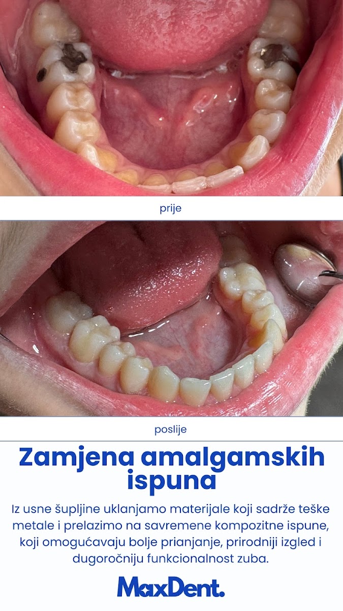 Stomatološka ordinacija MaxDent Sarajevo - foto 3