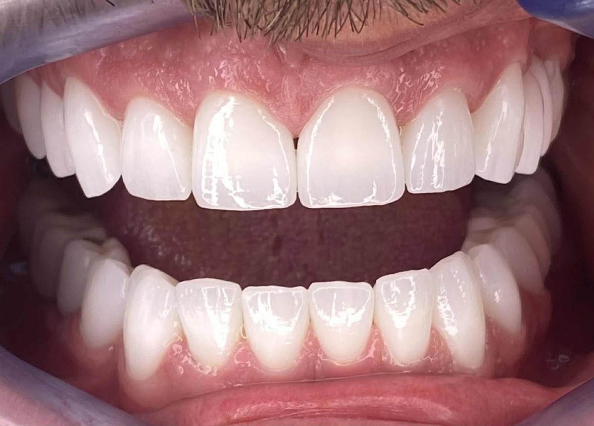 Stomatološka ordinacija Smile Spot Sarajevo