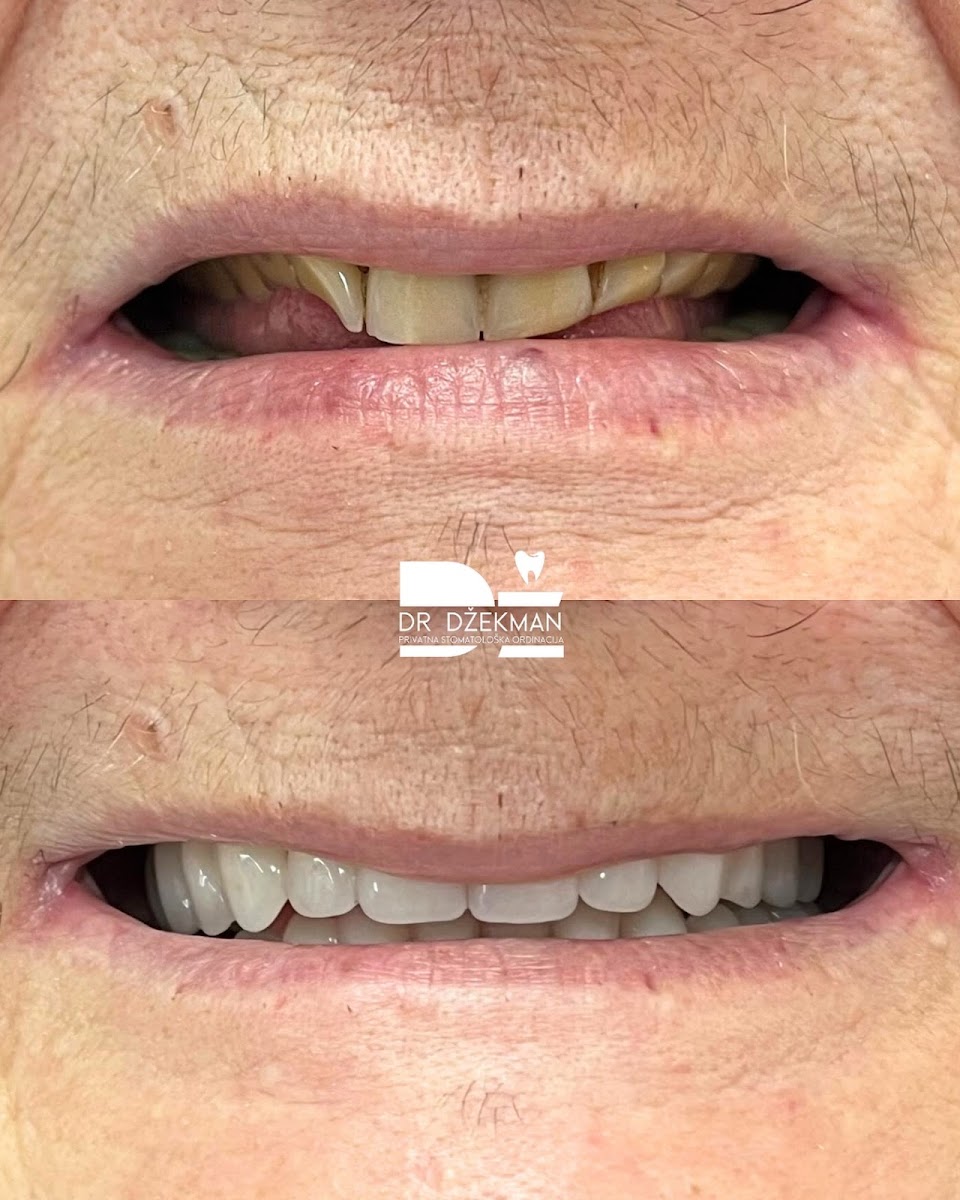 Stomatološka ordinacija Dr Džekman - foto 3