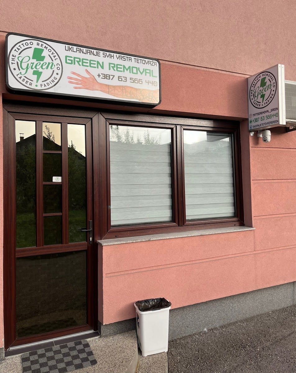 Lasersko skidanje tetovaža Green - foto 2