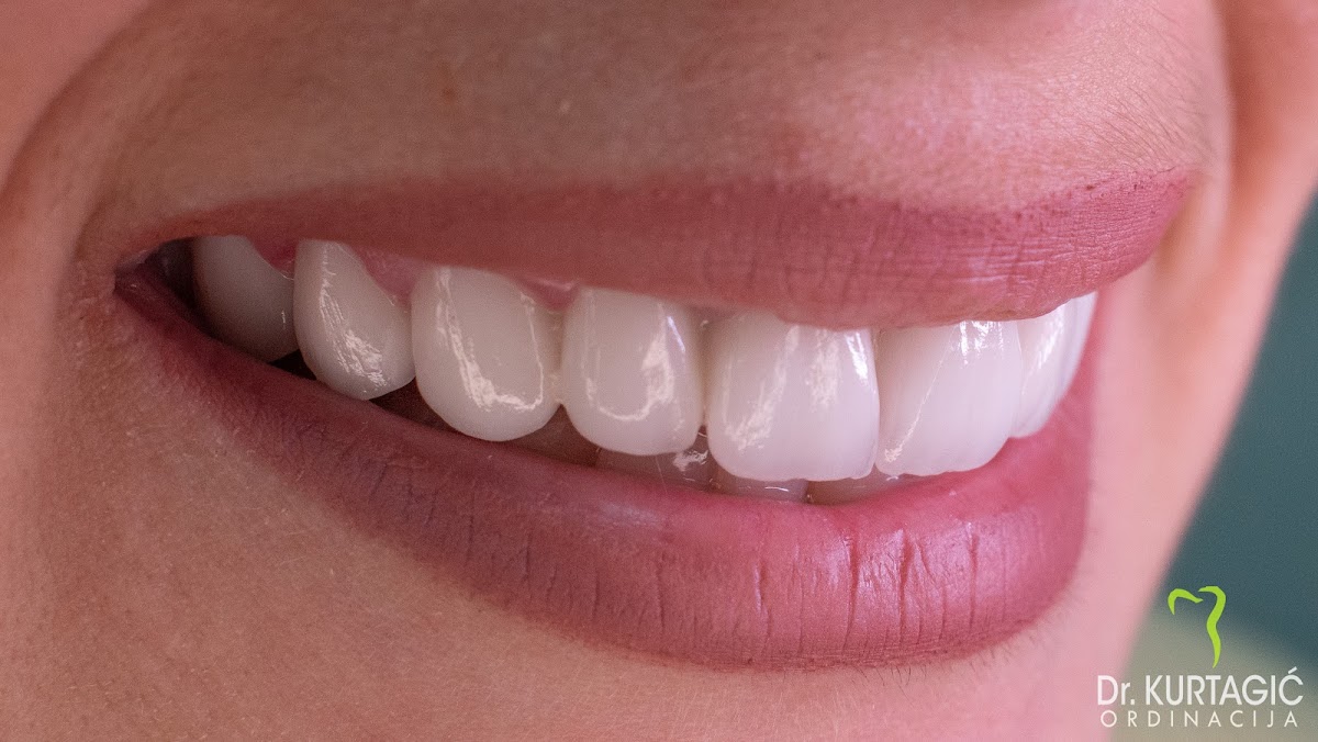 Dental Clinic Dr. Kurtagic, Sarajevo