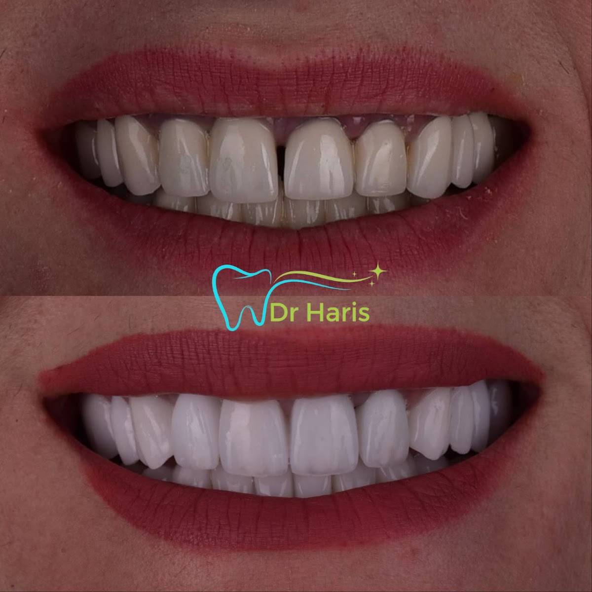 Stomatolog Dr HARIS - foto 2
