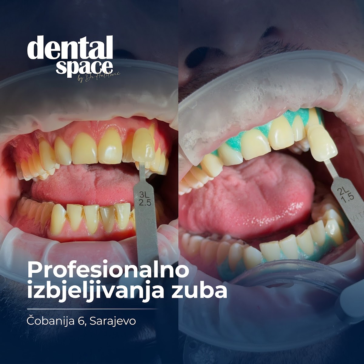 "Dental Space" Dr Halilović, Sarajevo