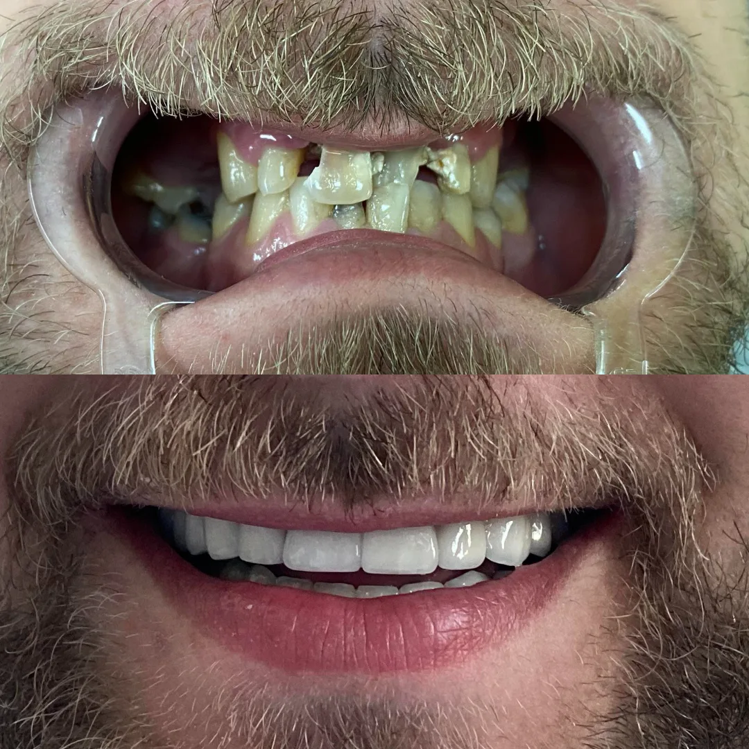 Stomatološka ordinacija "BIR-dent" - foto 2