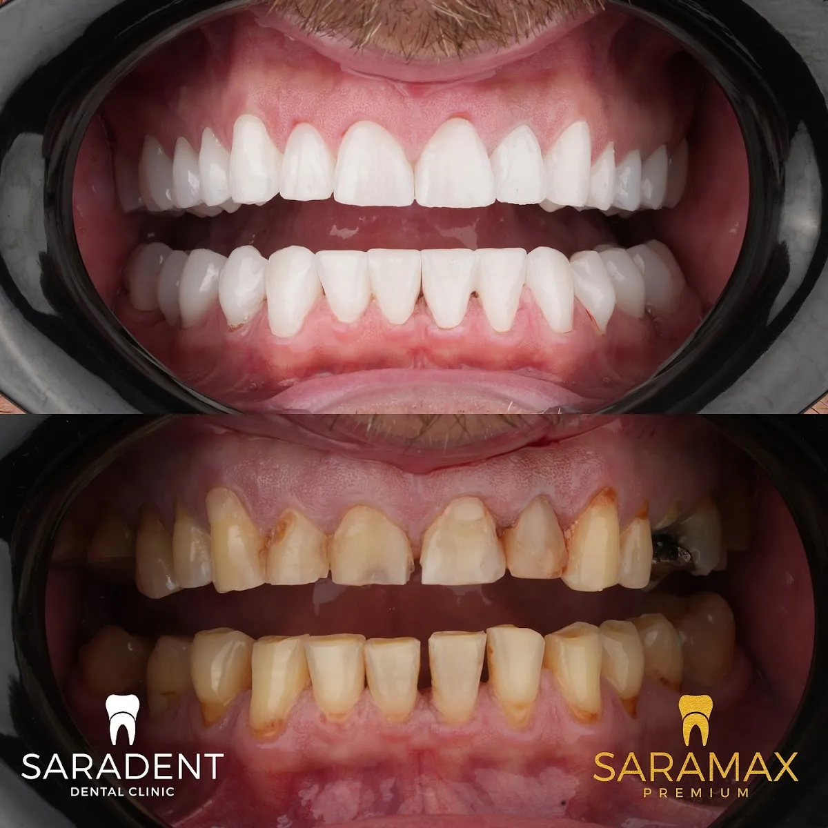 Saradent Dental Clinic | Stomatolog Sarajevo - Vogošća - foto 3