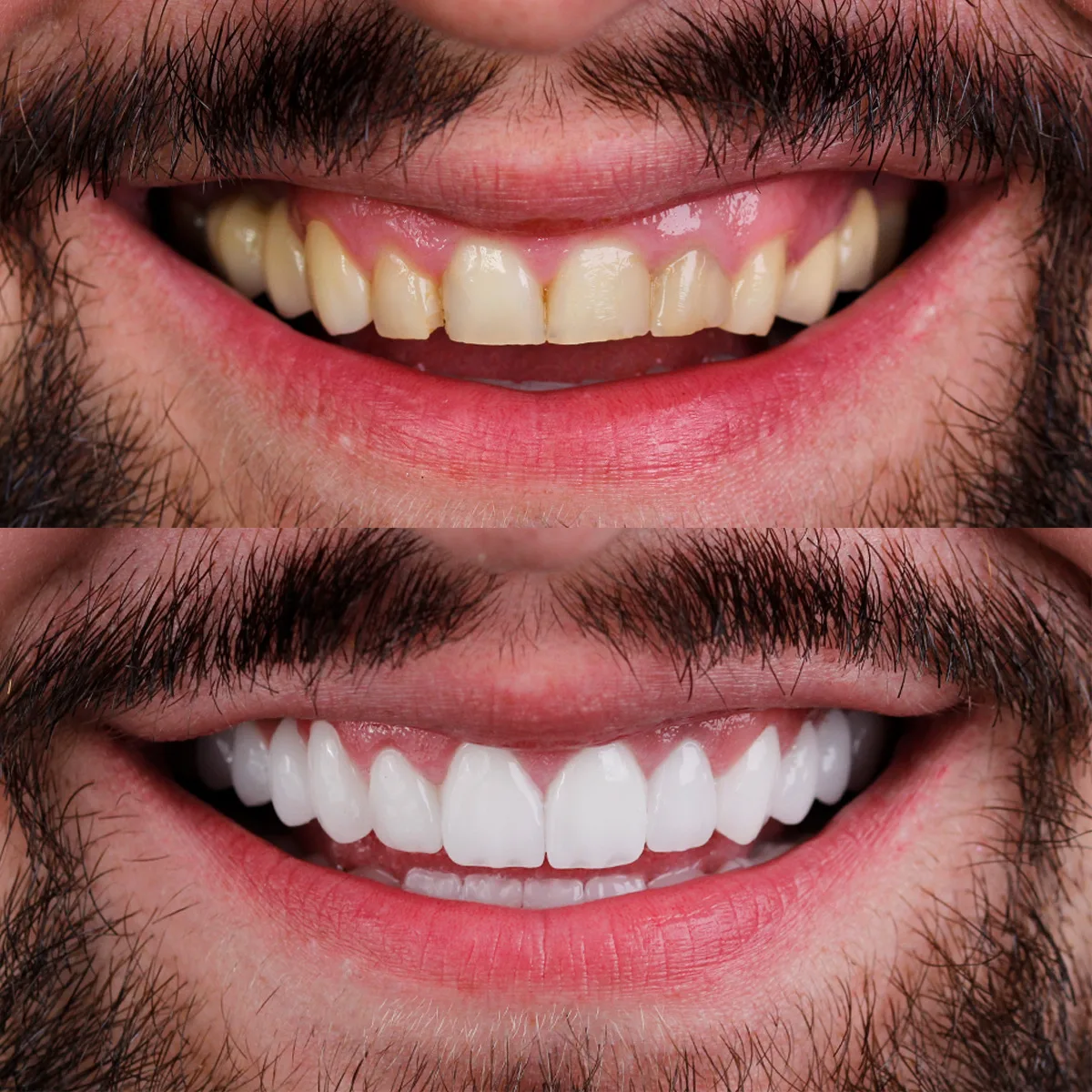 Centre for aesthetic dentistry Simić Dent - foto 3