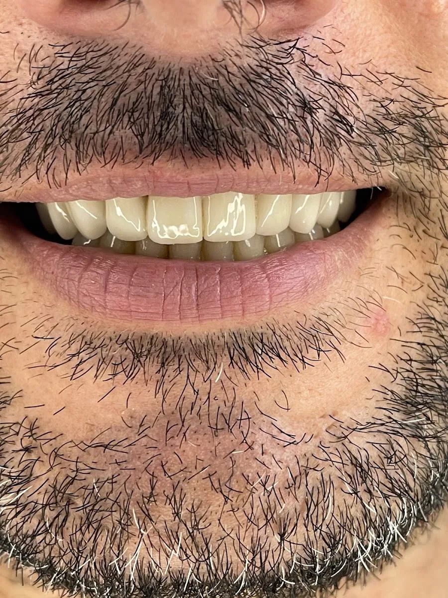 Dentalux - Estetik centar - foto 2