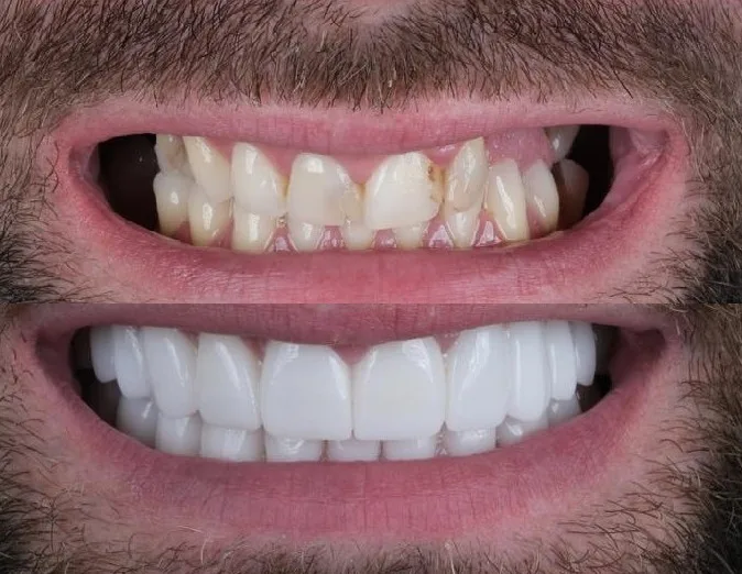 Stomatološka ordinacija Smile Design dr.Emina Bešić-Šehić - foto 3